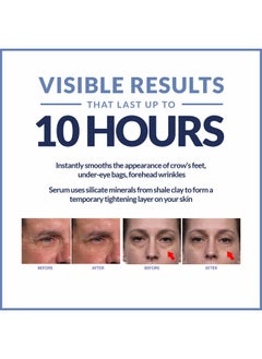 Plexaderm Rapid Reduction Eye Serum Pods Advanced Formula Anti Aging Serum Visibly Reduces Under Eye Bags Wrinkles Dark Circles Fine Lines & Crow'S Feet Instantly  - Image 5
