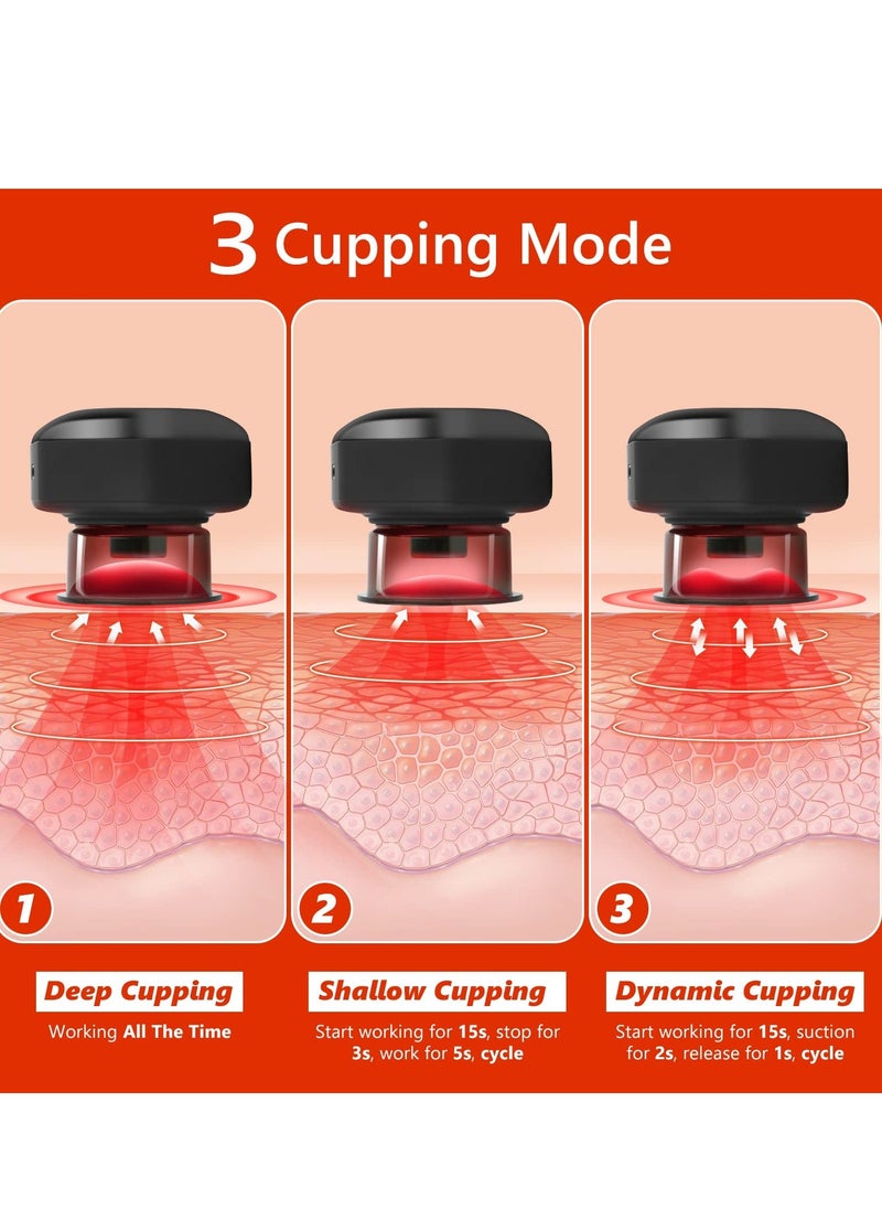 Y&D Smart Dynamic Cupping Therapy Set, Remote Control Set with Red Light for Pain Relief, Recovery, Massager 3 Mode, 16 Level Temperature and Suction  - Image 5
