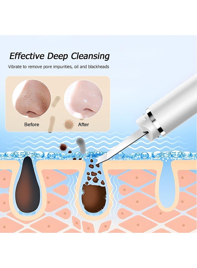 PULUZ Face Scrubber Skin Spatula, Black Head Remover for Face and Nose, Pore Cleaner Blackhead Remover Tools, Deep Cleansing Facial Whitehead Removal Extractor, Skin Care Gifts for Women - Image 4