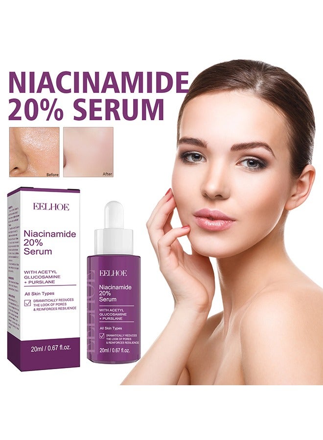 EELHOE Niacinamide 20% Serum -  Face Pigment Dark Spot Remover Face Serum, Anti Aging Fragrance Free Face Essence For For Discoloration And Minimizing Large Pores 20ml - Image 1