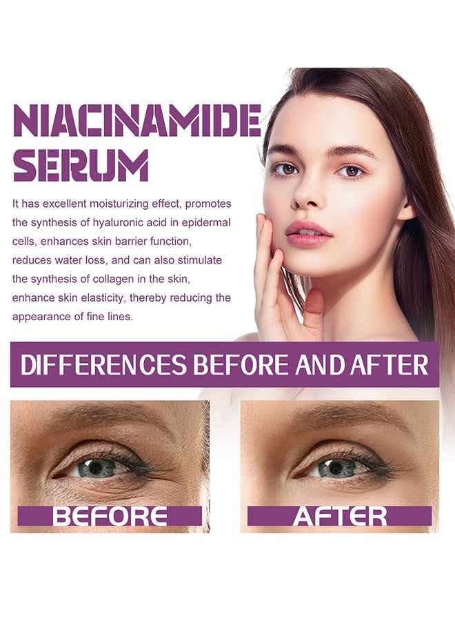 EELHOE Niacinamide 20% Serum -  Face Pigment Dark Spot Remover Face Serum, Anti Aging Fragrance Free Face Essence For For Discoloration And Minimizing Large Pores 20ml - Image 4