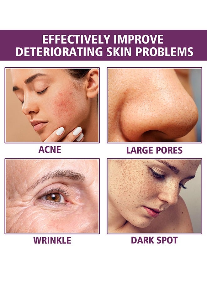 EELHOE Niacinamide 20% Serum -  Face Pigment Dark Spot Remover Face Serum, Anti Aging Fragrance Free Face Essence For For Discoloration And Minimizing Large Pores 20ml - Image 5