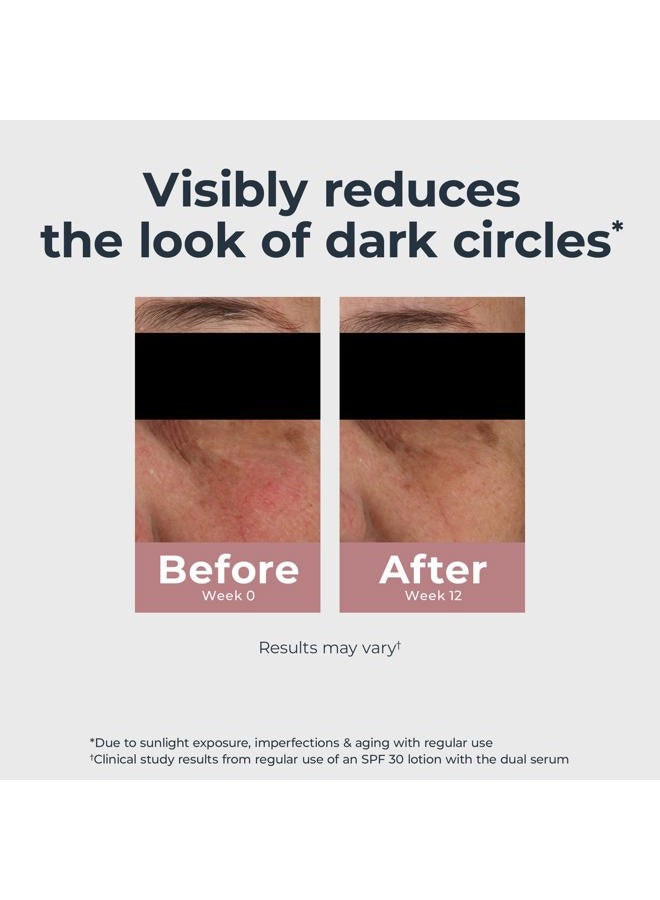 Eucerin كريم العين لتصحيح الهالات السوداء تون مشع، كريم تفتيح العين مع ثياميدول وحمض الهيالورونيك، يساعد في تقليل مظهر انتفاخ العينين، أنبوب 0.5 أونصة - Image 3