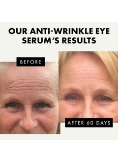 ??? ????* Eye Serum - Under Eye Cream For Dark Circles And Puffiness - Anti Aging Eye Cream, Under Eye Brightener Eye Bags Eye Treatment, Caffeine Eye Cream Puffy Eyes Treatment Dark Circle - pzsku/Z525D2F9D5D0BB8EC58F7Z/45/_/1734437917/7cd33ec0-8e87-454a-9f26-b6366c303743