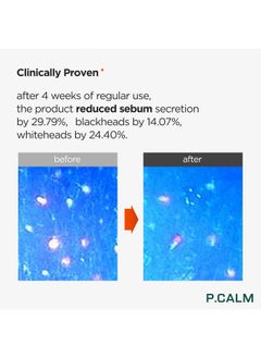 P.CALM P.CALM Barrier Cycle Toner 200ml | Vegan Alcohol-Free Fragrance-Free Toner for Sensitive Skin | Korean Skincare  - Image 3