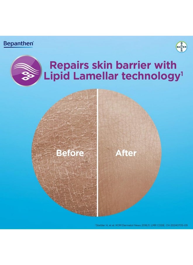 Bepanthen Bepanthen SensiCalm Cream For Face & Body, Worlds No.1 Skincare Brand, Itch Relief Cream For Eczema, Dry & Sensitive Skin 50g  - Image 5