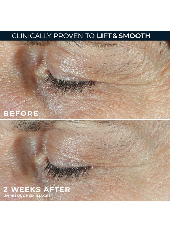 RoC كريم العين المزدوج من روك ديرم كوركشن مع ريتينول متقدم + ببتيدات للعيون المنتفخة والهالات السوداء، (0.68 أونصة) مع عينة كريم العين بالريتينول - Image 4