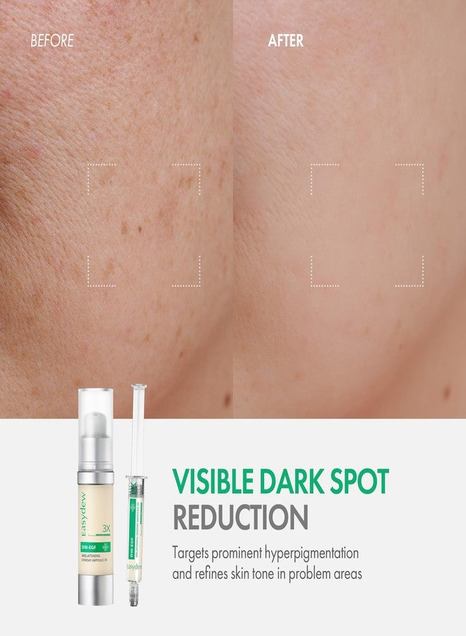 Easydew DW-EGF Melatoning Ampoule 3X - Hydrating Dark Spot Serum with Niacinamide & Glutathione for Uneven Skin - Fast Absorbing Day & Night Ampoule Korean Skin Care (Bottle 1.01 fl oz, EGF 3X) - Image 3