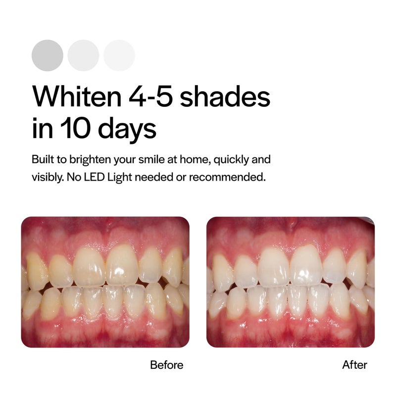Opalescence Go - Prefilled Teeth Whitening Trays - Original 15% - (4 Treatments) - Hydrogen Peroxide with PF - Cool Mint - Made by Ultradent. 4648-1 - Image 4