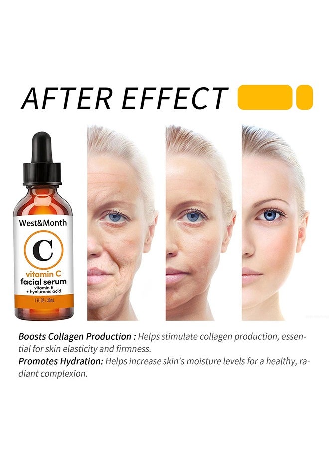 West&Month - Vitamin C Fcaial Serum - Brightening Skin Corrector for Face with Vitamin E and Hyaluronic Acid Boost Skin Collagen Hydrate and Plump Skin Anti Aging and Wrinkle Facial Serum 30ml - Image 1