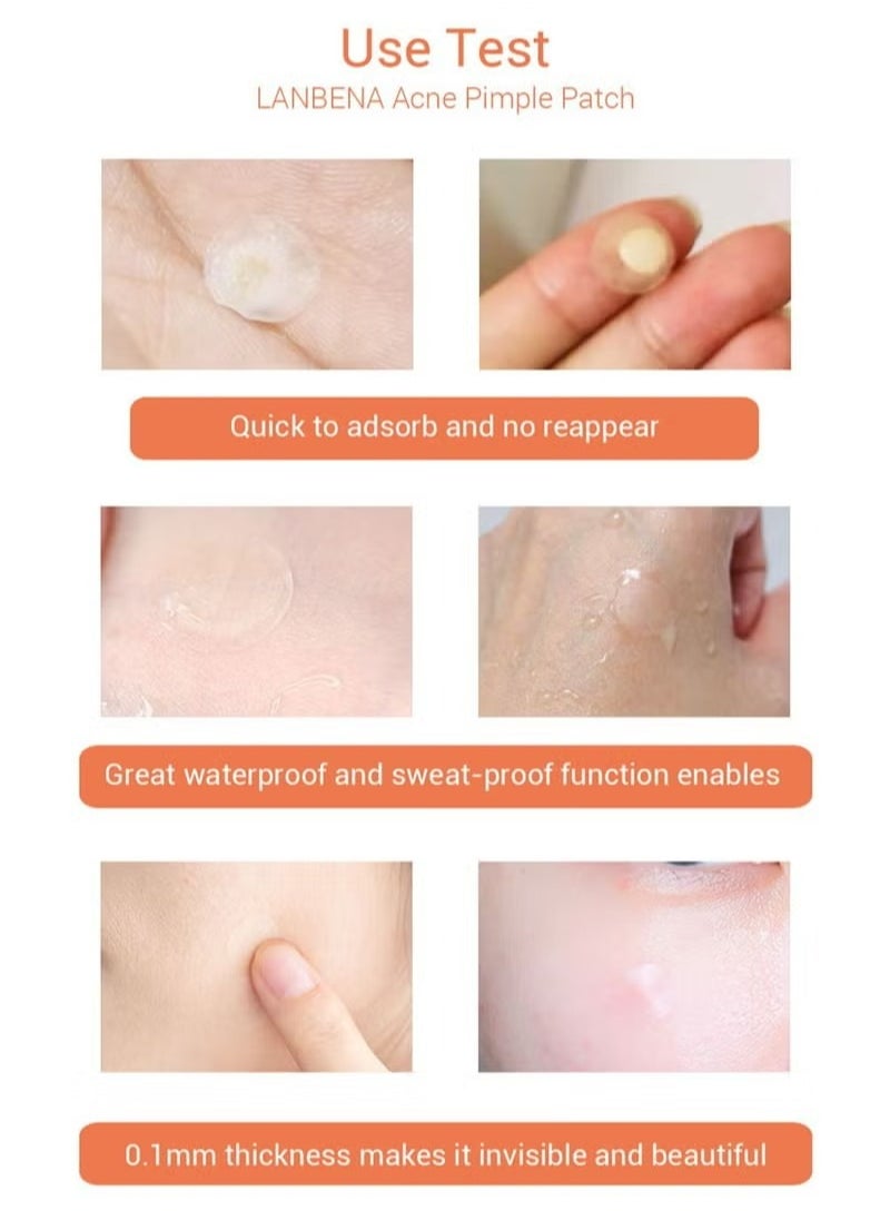 LANBENA 1 Pcs Lanbena Acne Pimple Patch Invisible Spot Patch Mask Anti- Acne Acne Patch Pore Eraser (Night Use)  - Image 4