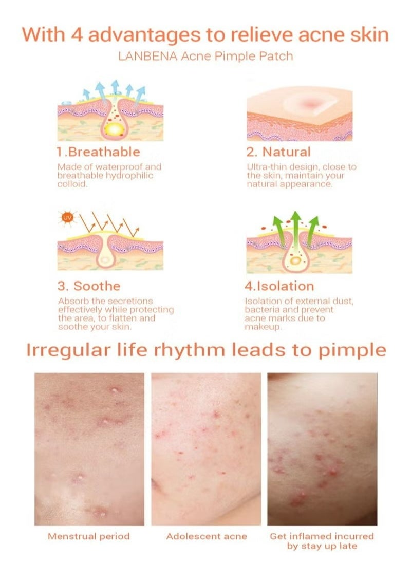 LANBENA 1 Pcs Lanbena Acne Pimple Patch Invisible Spot Patch Mask Anti- Acne Acne Patch Pore Eraser (Night Use)  - Image 5