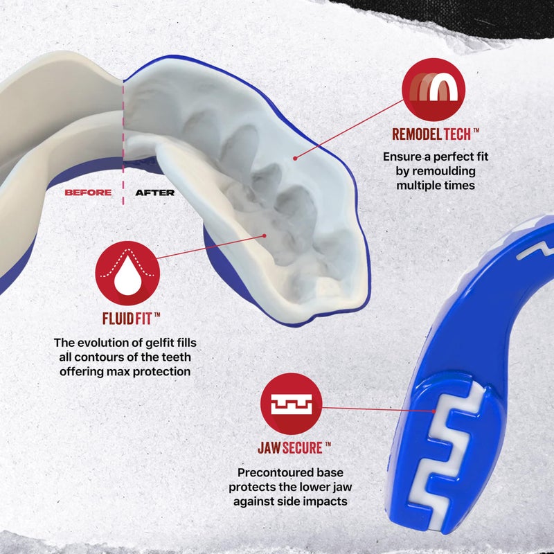SafeJawz Sports Mouthguard, Dual Layer Premium Protection Mouth Guard with Case for Boxing, Basketball, Lacrosse, Football, Martial Arts, Hockey and All Contact Sports (Junior <11 Years, Shark) - Image 3