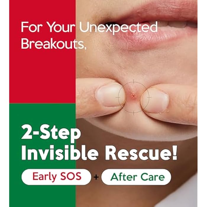 Troubless Invisible Plus Spot Patch EARLY SOS + AFTER CARE Set – Dual Care Hydrocolloid Patches for First Signs and Post-Care – Thin & Comfortable Wear w/ Strong Adhesion (1cm & 1.2cm, 96 ea) - Image 3