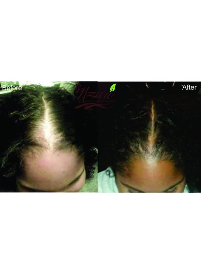Nzuri Elixir Hair Skin and Nail with Vitamin D - 32 Oz + Nzuri Hair Follicle Food 61- Ancient Miracle Hair Growth Oil 4oz Vitamins to Make Hair Grow Long Intense Grow Long Hair Supplements Combo pack - Image 4