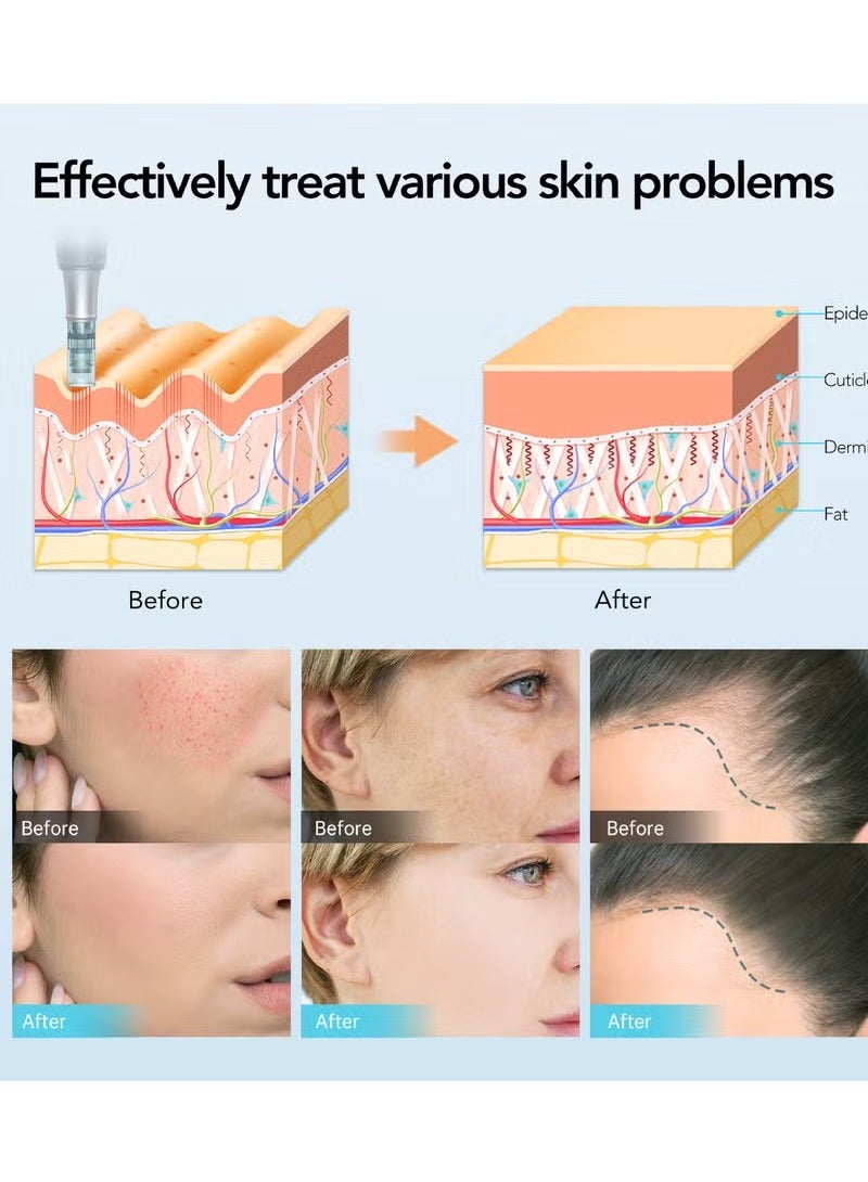 Dr.pen Dr.Pen M7S Microneedle Roller Kit – Home Acne Scar & Hair Growth Treatment | 6x16Needles,6x36 Needles,6x42Needles,2xNano Needles,M8 Cartridge Compatible - Image 5
