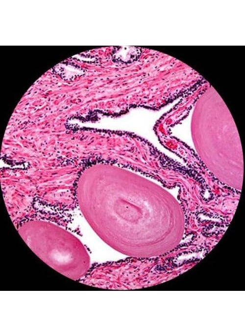 AmScope M620CE1 Digital Compound Monocular Microscope WF10x and WF25x Eyepieces 40x2500x Magnification Brightfield LED Illumination Abbe Condenser Mechanical Stage 110V Includes 13MP Camera and Software