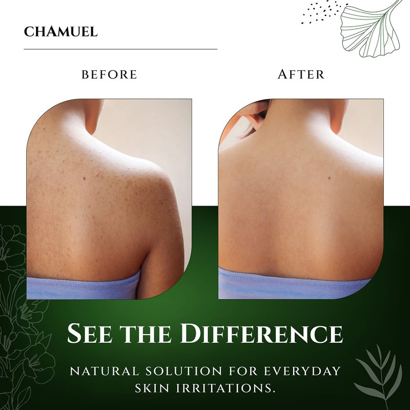 Chamuel Tea Tree Body Wash - Made With Natural Ingredients To Fights Itchy Skin, Body Odor, Athlete's Foot, Jock Itch & Toenails Issues - Organic Scented - Men & Women (11.8oz) - Image 4