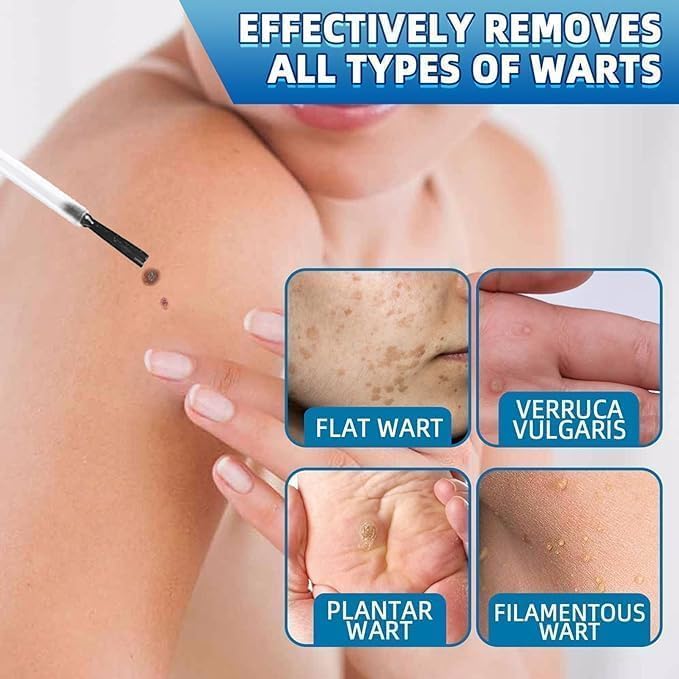 Makbeaty Tag and Wart Remover Natural Plant Formula Portable Skin Care Skin Tag Corrector for Face and Body,Fast-Acting and Effect，2PCS - Image 3