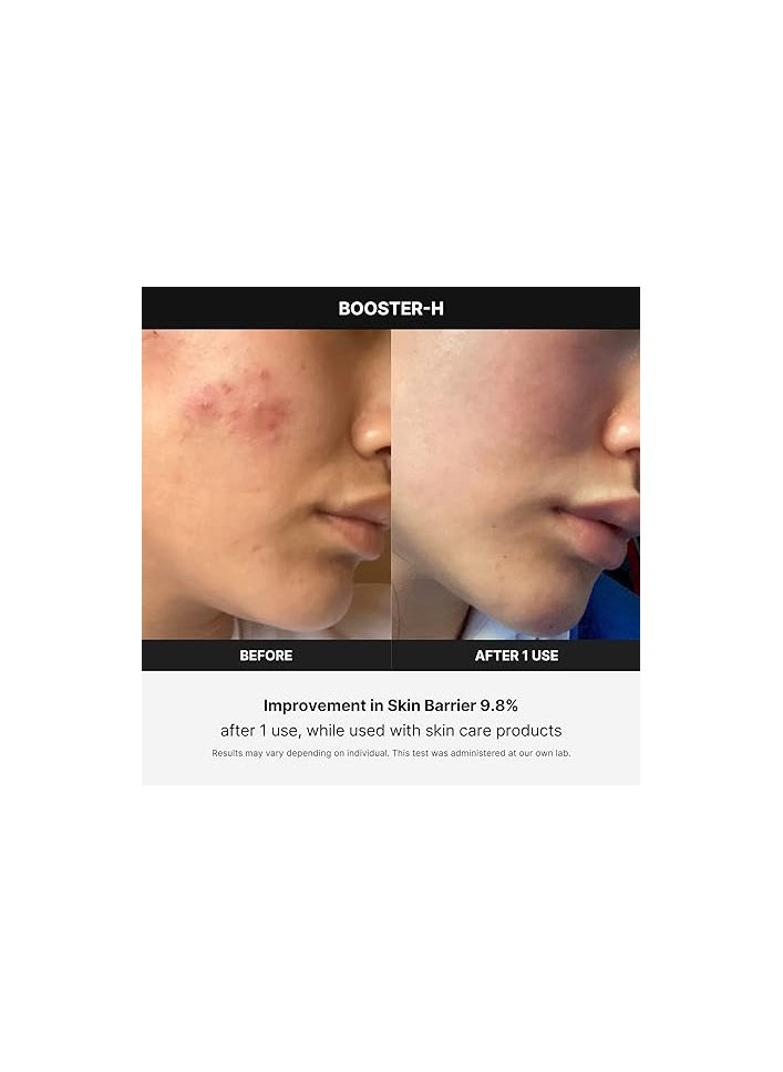 Medicube Age-R Booster H - a Facial Treatment Device for Maximizing and Boosting Skin Care Absorption