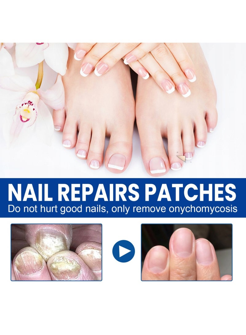 سيمونث تصحيحات الأظافر - العناية بأظافر القدم لأظافر القدم - تجديد الأظافر لمدة 8 ساعات في الليل - 60 - Image 3