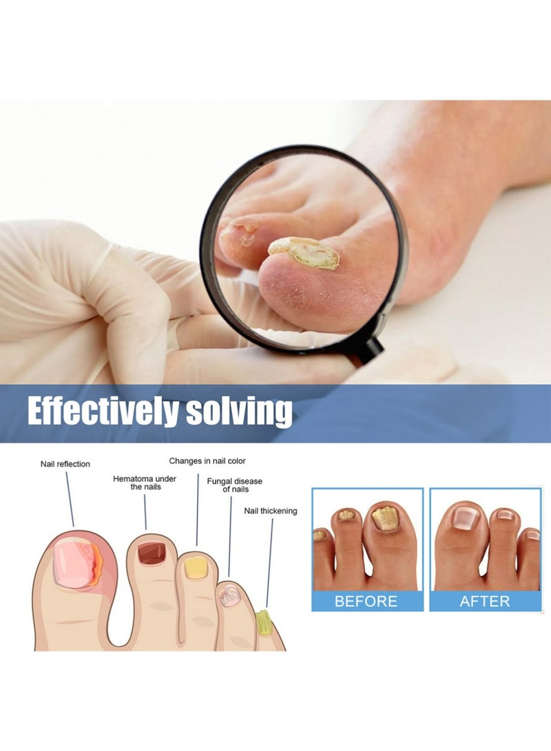 سيمونث تصحيحات الأظافر - العناية بأظافر القدم لأظافر القدم - تجديد الأظافر لمدة 8 ساعات في الليل - 60 - Image 4