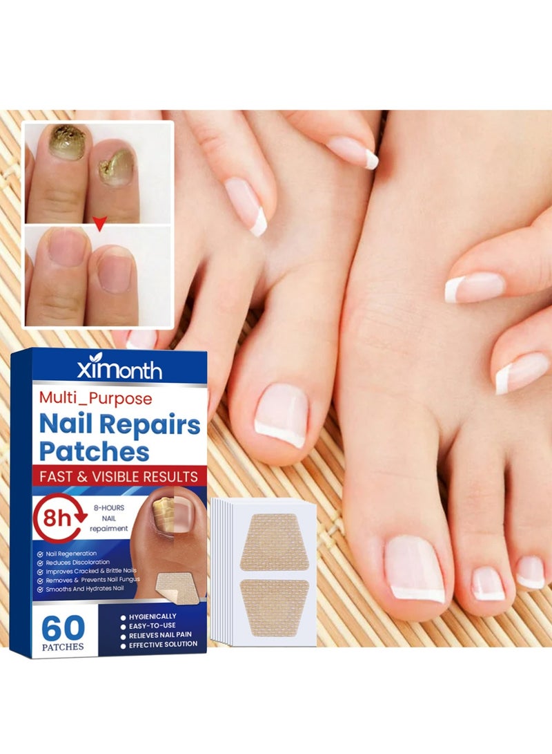 سيمونث تصحيحات الأظافر - العناية بأظافر القدم لأظافر القدم - تجديد الأظافر لمدة 8 ساعات في الليل - 60 - Image 1