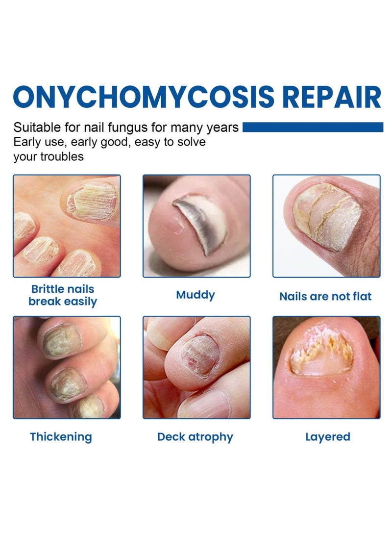 سيمونث تصحيحات الأظافر - العناية بأظافر القدم لأظافر القدم - تجديد الأظافر لمدة 8 ساعات في الليل - 60 - Image 2