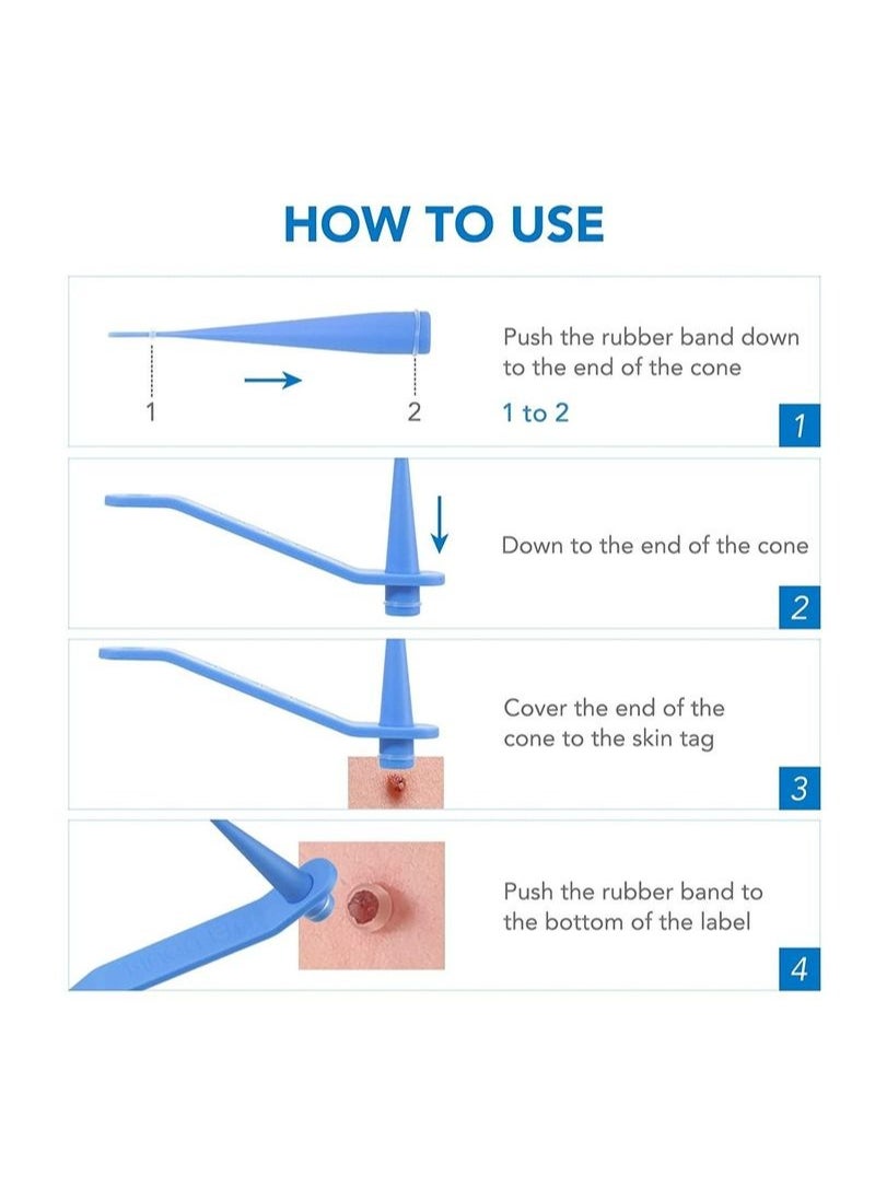 2 In 1 Design Skin Tag Removal Kit Double Sided Design Safe for All Kind Of Skin Tags For Small to Medium 2mm to 4mm Bands For Medium to Large 5mm to 8mm Bands Unisex