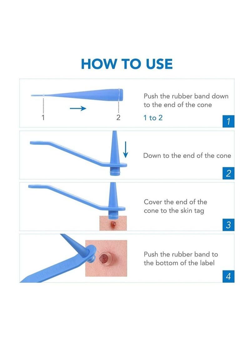 Sefudun - 2 In 1 Design Skin Tag Removal Kit Double Sided Design Safe for All Kind Of Skin Tags For Small to Medium 2mm to 4mm Bands For Medium to Large 5mm to 8mm Bands Unisex - Image 1