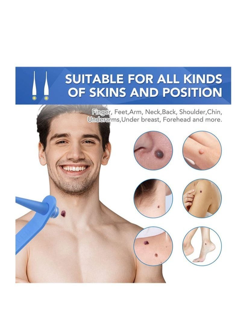 Sefudun - 2 In 1 Design Skin Tag Removal Kit Double Sided Design Safe for All Kind Of Skin Tags For Small to Medium 2mm to 4mm Bands For Medium to Large 5mm to 8mm Bands Unisex - Image 1