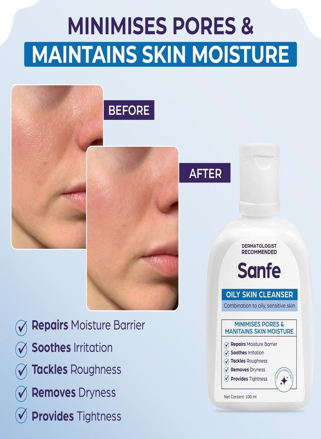 Sanfe Oily Skin Cleanser | Minimises Pores & Maintains Skin Moisture | For skin repair, roughness, dryness, tighter skin | Daily Cetaphil Face Wash For Oily, Acne Prone Skin | Cetaphil Gentle Foaming - 100ml - Image 2