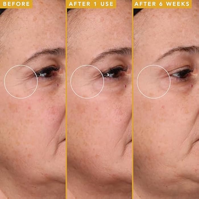 Farmacy Filling Good Hyaluronic Acid Serum for Face - Anti Aging Skin Care + Hydrating Face Serum - Plumps, Smoothes & Helps to Visibly Improve Skin Firmness for a Youthful Complexion (5ml) - Image 4