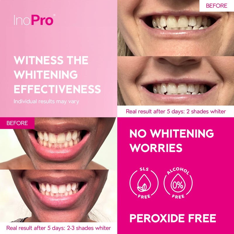 InoPro Teeth Whitening Strips 14 Treatments Kit - Enamel Safe Teeth Whitener, Peroxide-Free, Green White Strips for Teeth Whitening with Arbutin, Coconut Oil, Deep Stains Removal (28 Strips) - Image 3