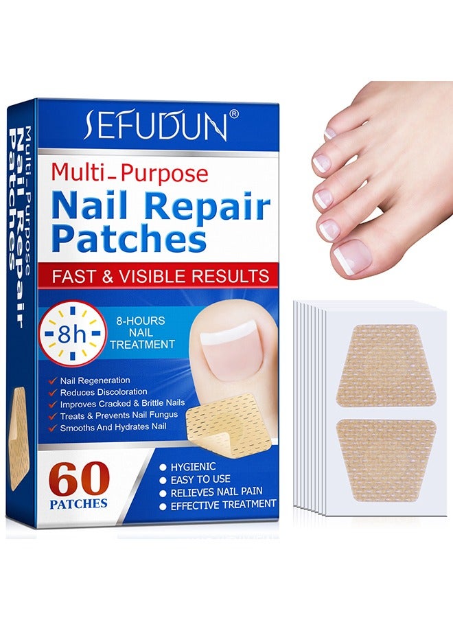 سيفودون بقع إصلاح الأظافر المعطي الغرض ، 60 قطعة علاج إصلاح الأظافر بين عشية وضحاها لتغير لون الأظافر وتشققها ، واستعادة مظهر الأظافر الصحي - Image 1