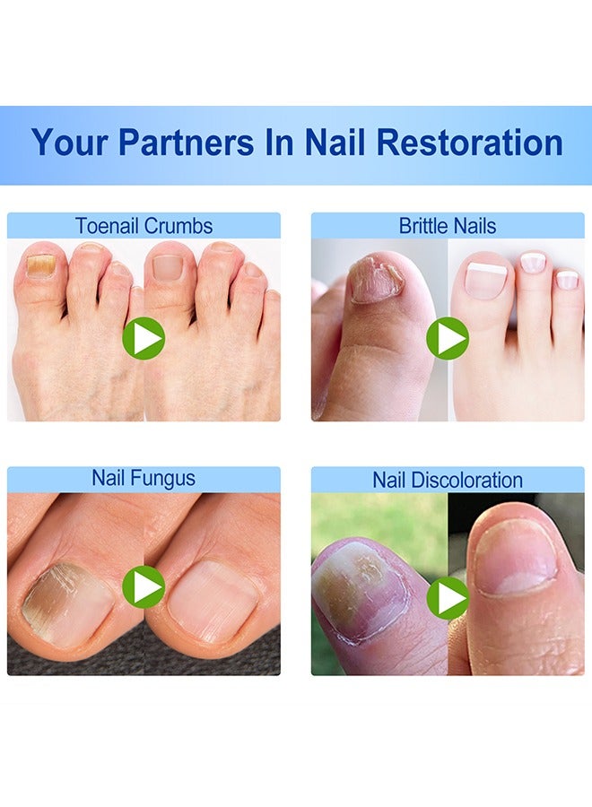 سيفودون بقع إصلاح الأظافر المعطي الغرض ، 60 قطعة علاج إصلاح الأظافر بين عشية وضحاها لتغير لون الأظافر وتشققها ، واستعادة مظهر الأظافر الصحي - Image 3