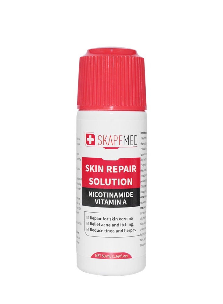 SKAPEMED 50ml Skin Repair Solution Nicotinamide Vitamin A for Tinea and Herpes Acne and Itching Relief Serum Prevent and Treatment of Athlete's Foot Eczema Repair Serum - Image 2