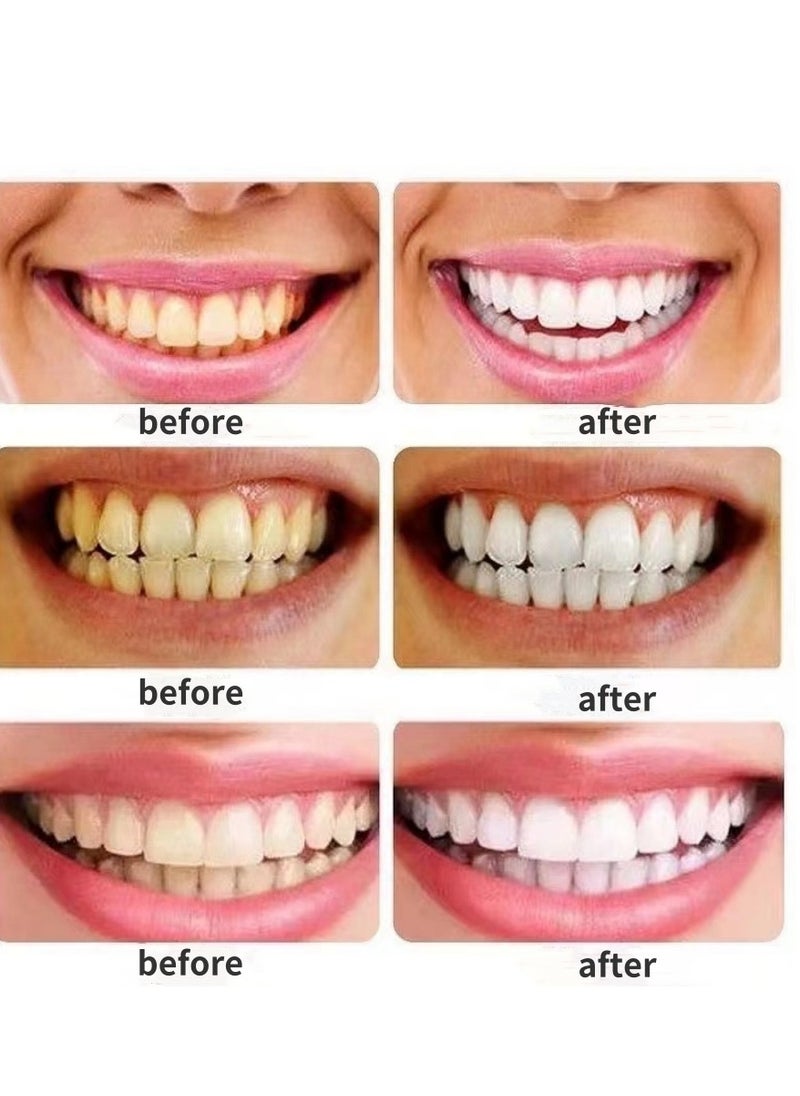 14 Pcs Sakura Teeth Whitening Strips ，Advanced Fast Effective 3 Days Significant Whitening Portable Comfortable Easy to Use  and Effective Stains Removal，Remove Dental Plaque. ﻿ - pzsku/Z52E1063DD3682388B170Z/45/_/1713319368/37365712-8376-4f3a-84ae-4dd9ce86ca55