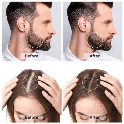 BHUMLO Derma Roller For Beard Hair Skin Face 540 Titanium.25Mm - Self Care Gifts Facial Skin Care Tools, Hair Scalp Massager Shampoo Brush With Soft Silicone Bristles Comb Scrubber - Image 2