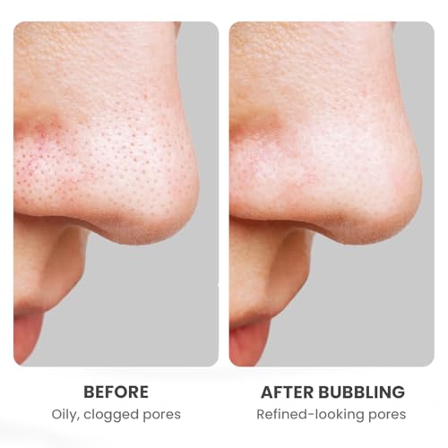 GLAM UP Clean Bubbling Carbonated Clay Mask for Face Purifying- Blackhead Remover, Peel Off, Pore Clearing, Deep Cleansing, Detoxing Bubble Clay Mask, Vegan 135ml (4.56 Fl Oz) - Image 5