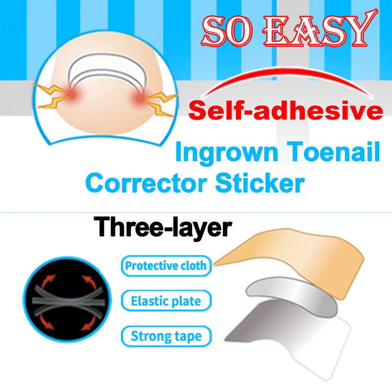Ingrown Toenail Correction Set Treatment Kit Stainless Steel Ingrown Toenail Correcter Lifter Tweezers Toenail Sticker Spring Strips Toe Protectors Foot Care Tool Kit - Image 3