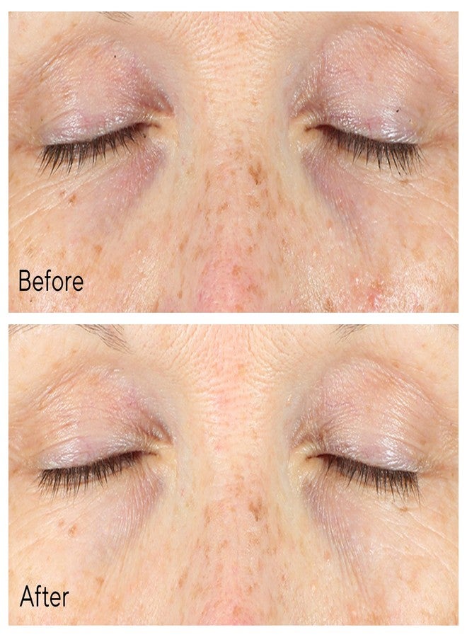 Murad مصحح دوائر العين الداكنة من مورايد فيتا-سي - فيتامين سي المستقر بالذهب، سيروم العين بالطحالب والخيار لتفتيح البشرة، وتقليل الانتفاخ، وتنعيم الخطوط الدقيقة - 0.5 أونصة سائلة - Image 5