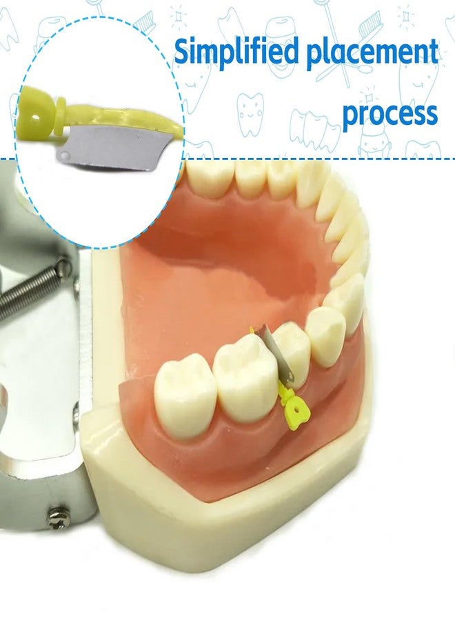 Ceonam 50 Pack Dental Sectional Matrix Wedges - Teeth Restoration Contouring Wedges and Metal Matrices for Molar and Premolar Procedures, Orthodontic Tools Kit - Image 4
