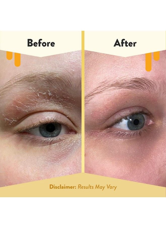 ECZEMA HONEY - Multi Peptide Eye Cream Anti Aging Eye Cream For Dark Circles & Puffiness Facial Skin Care Products For Eczema Dry & Sensitive Skin (0.5 Oz) - Image 1