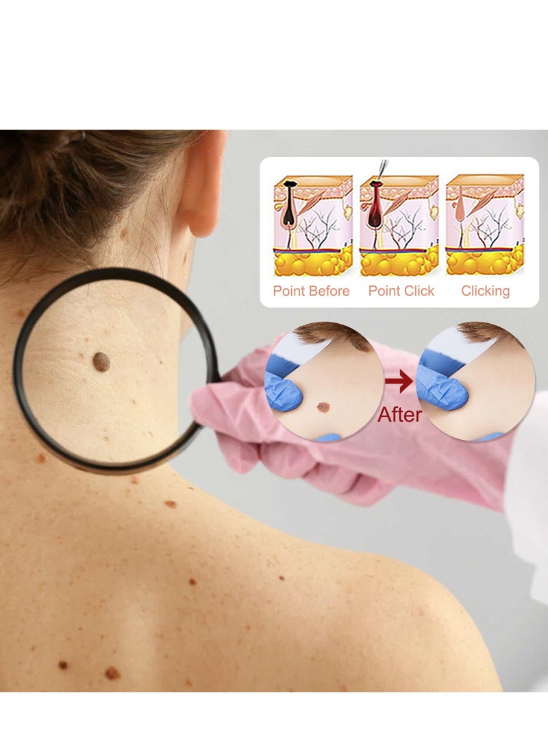 EELHOE - Natural Skin Mole Remover Liquid - Image 1
