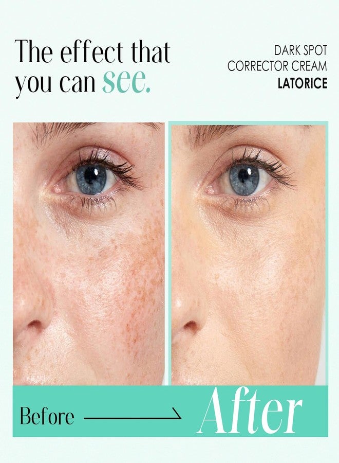 LATORICE Dark Spot Remover for Face and Body: Tranexamic Acid Serum for Women and Men - Reduce Sun Spot Melasma Freckles (1.7 Fl Oz) - Image 3