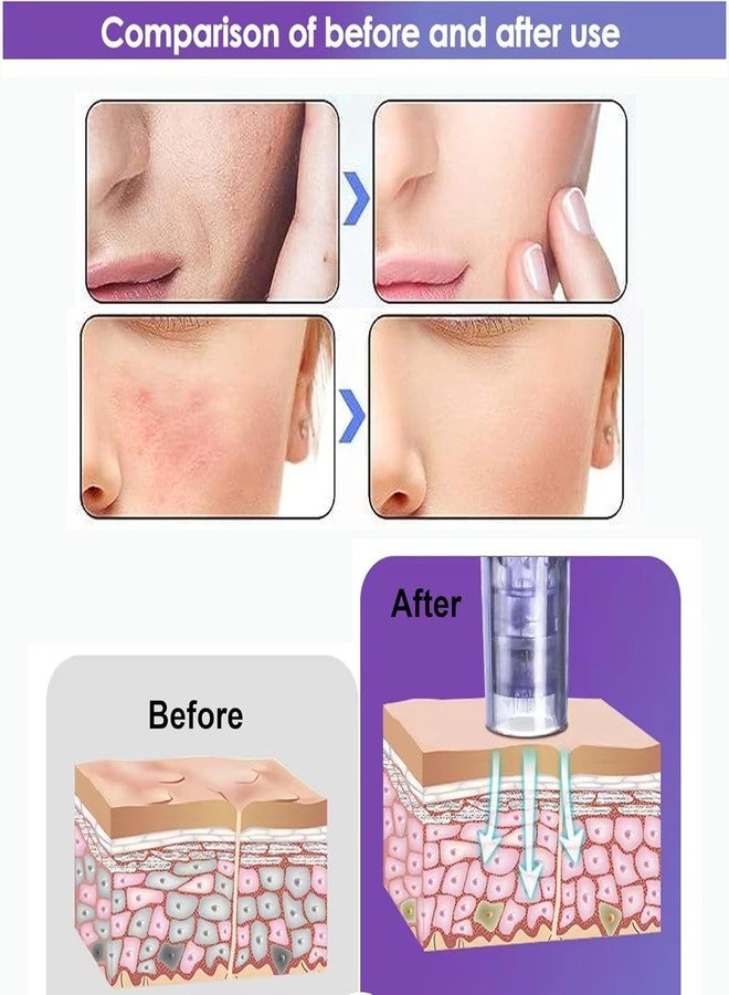 Elitzia Non-Needle Injection Facial Rejuvenation Skin Care Tools Instrument 2 Cartridges for Home Use ETNV6138 - Image 2