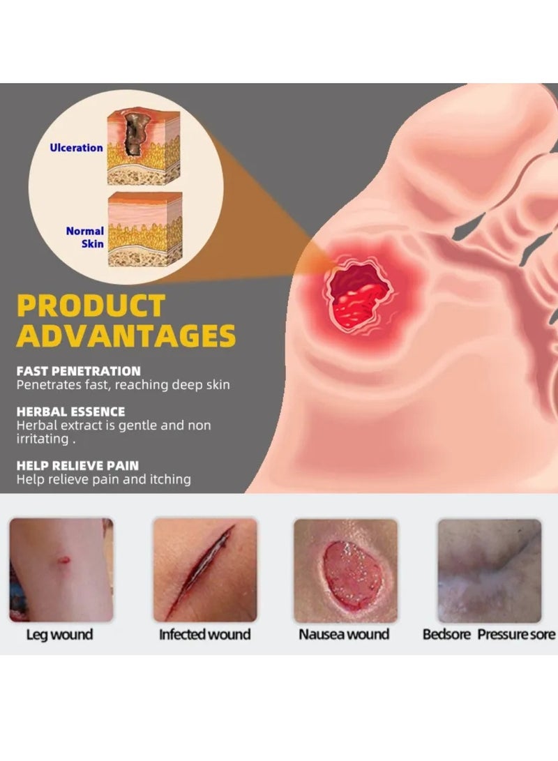 Sumifun كريم قرحة الفراش علاج قرحة الفراش مكونات طبيعية لشفاء قرحات الفراش قرحات الضغط الجروح المؤلمة عمل لتخفيف الألم مرهم 20 جرام - Image 2