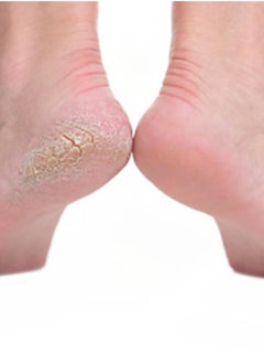 NIBEMINENT Pedicure Foot File Orange/Black  - Image 2