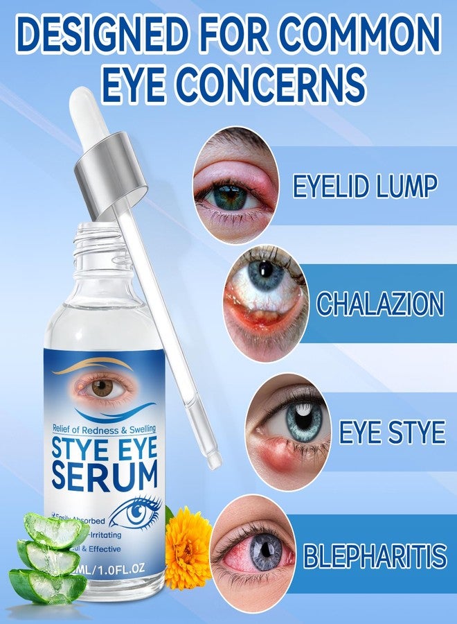HORSEFISH TOOL Stye Eye Treatment, 30ml Natural Eye Serum, Eye Stye Relief Serum for Eye Styes, Blepharitis, Chalazions and Dry Eyes Treatment, Daily Area Cleansing, Relieves Dryness and Restores Healthier Skin - Image 4